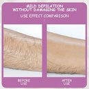 Removedor de pelos indolor - A depilação que você sempre sonhou!